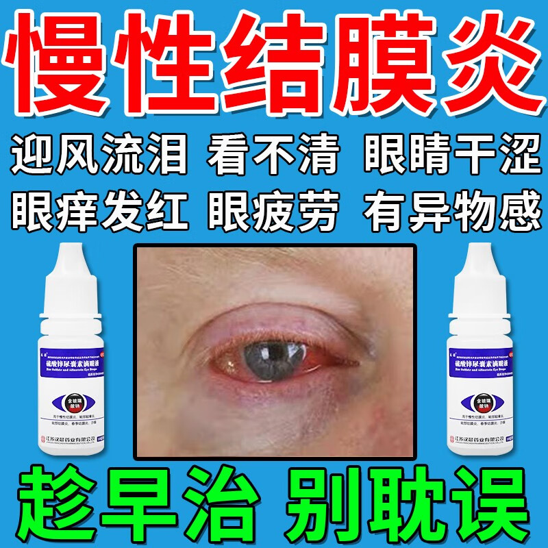 硫酸锌尿囊素滴眼液 10ml硫酸锌尿囊素滴过敏性慢性结膜炎眼药水眼睛