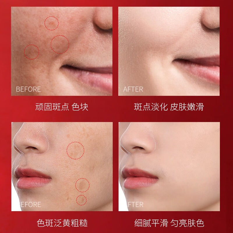 梦希蓝美白祛斑霜祛淡化斑点雀斑黄褐斑晒斑妊娠斑老年斑修护肤保湿面霜 一瓶【体验装】