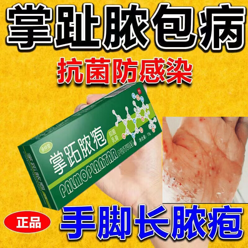 忆媞亭掌跖脓疱手掌长泡脓包痒掌手足泡疹干裂脱皮手足起脓包手掌