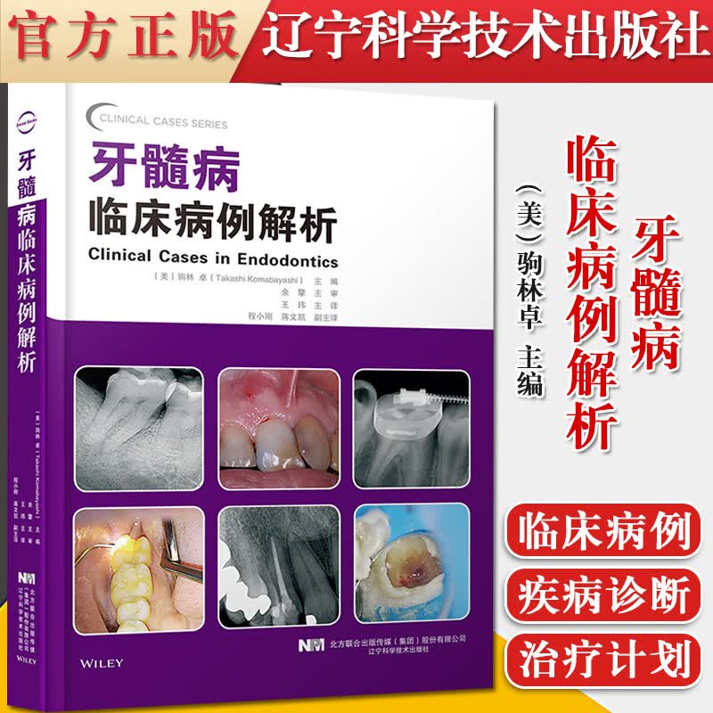 正版书籍 牙髓病临床病例解析 驹林 卓 主编 非手术根管治疗病例 根尖手术病例内吸收和外吸收病例