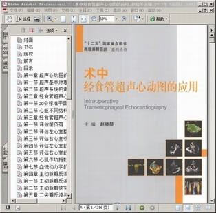 电子版  pdf文件 术中经食管超声心动图的应用_赵晓琴主_2013年(图)韩