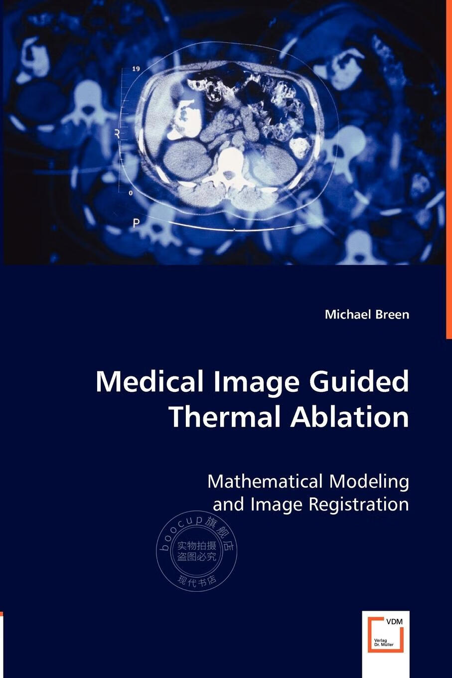 【2周达】【预售 按需印刷】medical image guided thermal ablation
