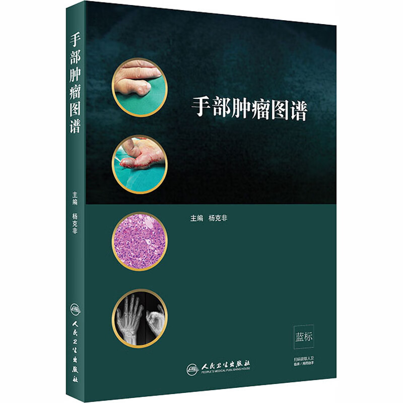 手部肿瘤图谱 杨克非 编 书籍