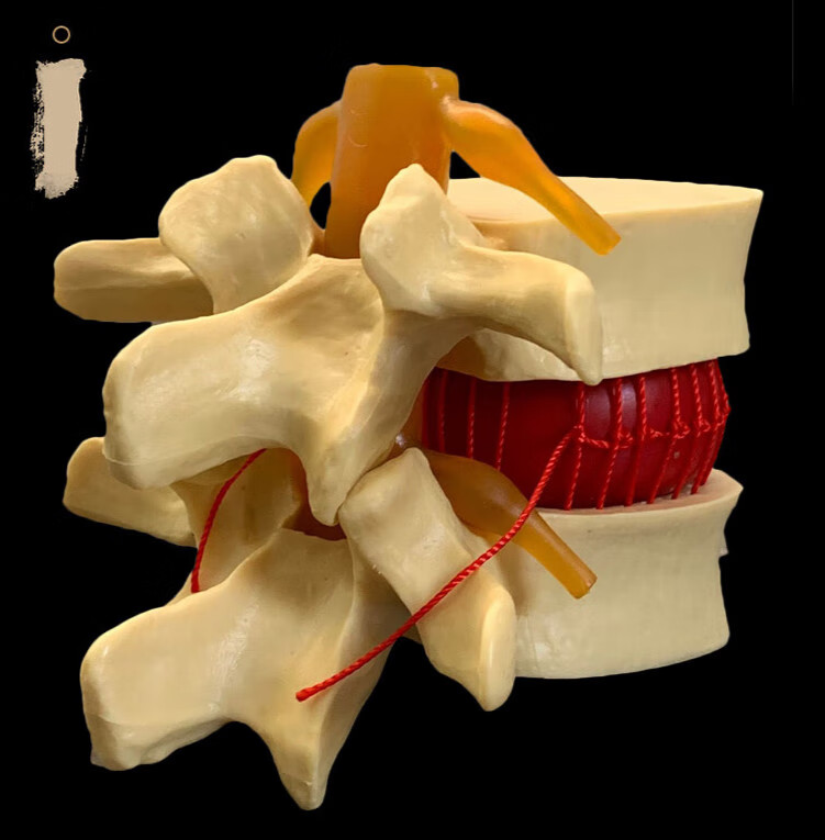 人体腰椎间盘演示模型腰椎模型脊柱模型脊椎模型关节模型 姜黄色
