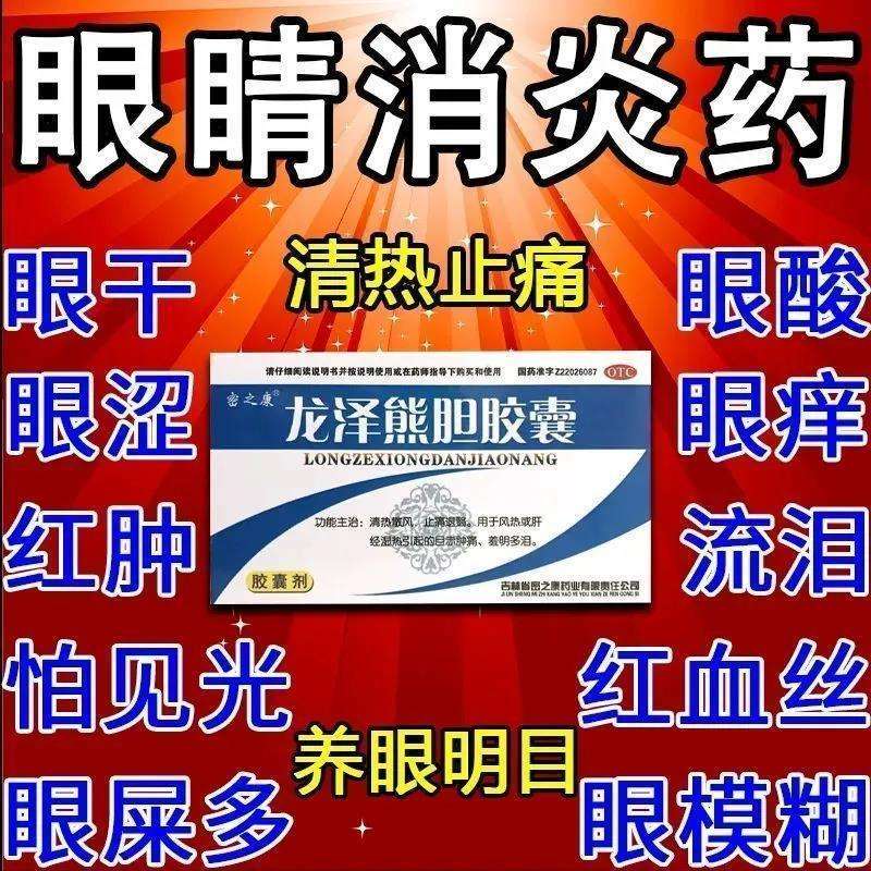 眼睛消炎止痛药 结膜炎眼干涩红肿疼痛眼睛痒怕光流泪眼睛模糊眼屎多