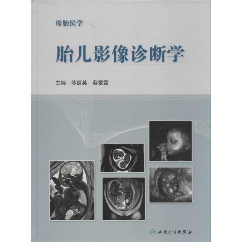 胎儿影像诊断学  书籍