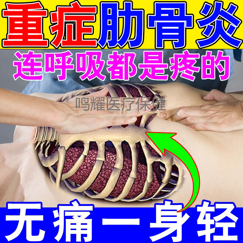 胸肋软骨炎肋骨炎贴膏鼓包肿大胸背闷痛钝疼压痛刺痛肋间神经炎痛