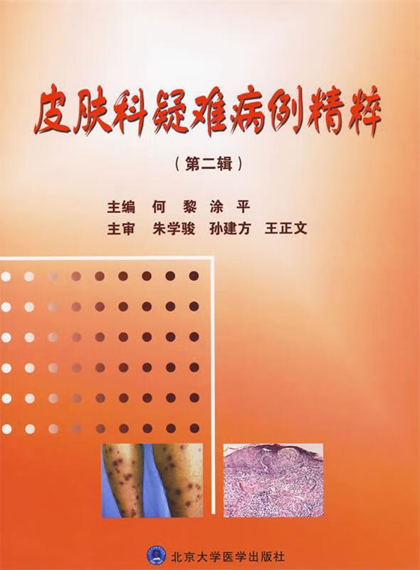 皮肤科疑难病例精粹