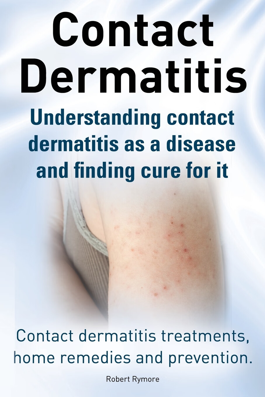 contact dermatitis treatments, home remedies and prevention.