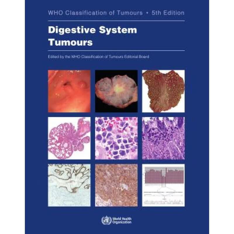 现货 消化系统肿瘤 Digestive System Tumours