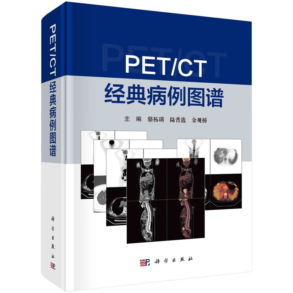 PET/CT经典病例图谱/骆柘璜,陆普选,金观桥