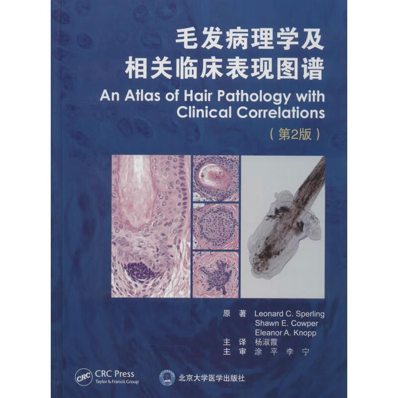 毛发病理学及相关临床表现图谱(第2版) 书籍