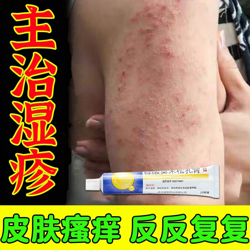 真菌感染药膏湿疹止痒湿疹婴儿成人专用otc药皮肤湿疹红肿瘙痒止痒膏