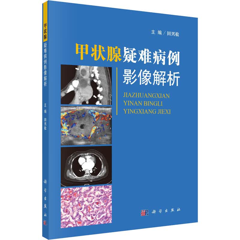甲状腺疑难病例影像解析