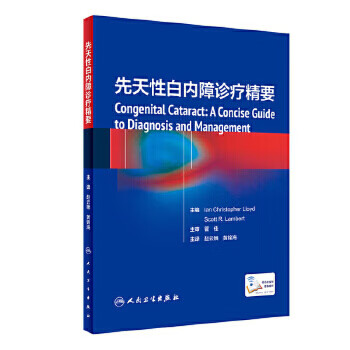 先天性白内障诊疗精要