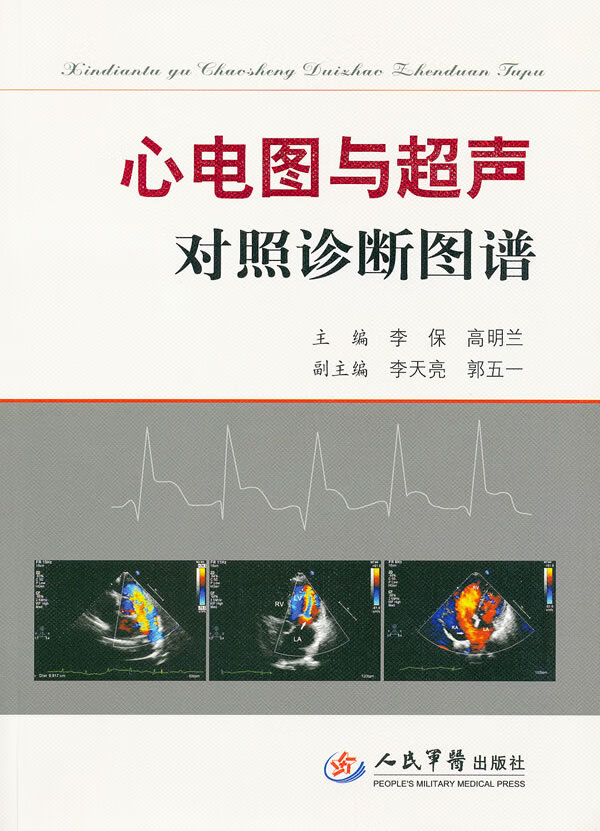 心电图与超声对照诊断图谱 李保,高明兰 心血管疾病诊断心电图与超声