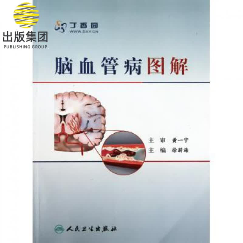 脑血管病图解