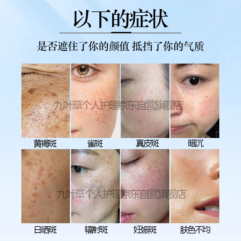九叶草美白祛斑霜淡化黑色素去雀斑黄褐斑提亮肤色男女士50g