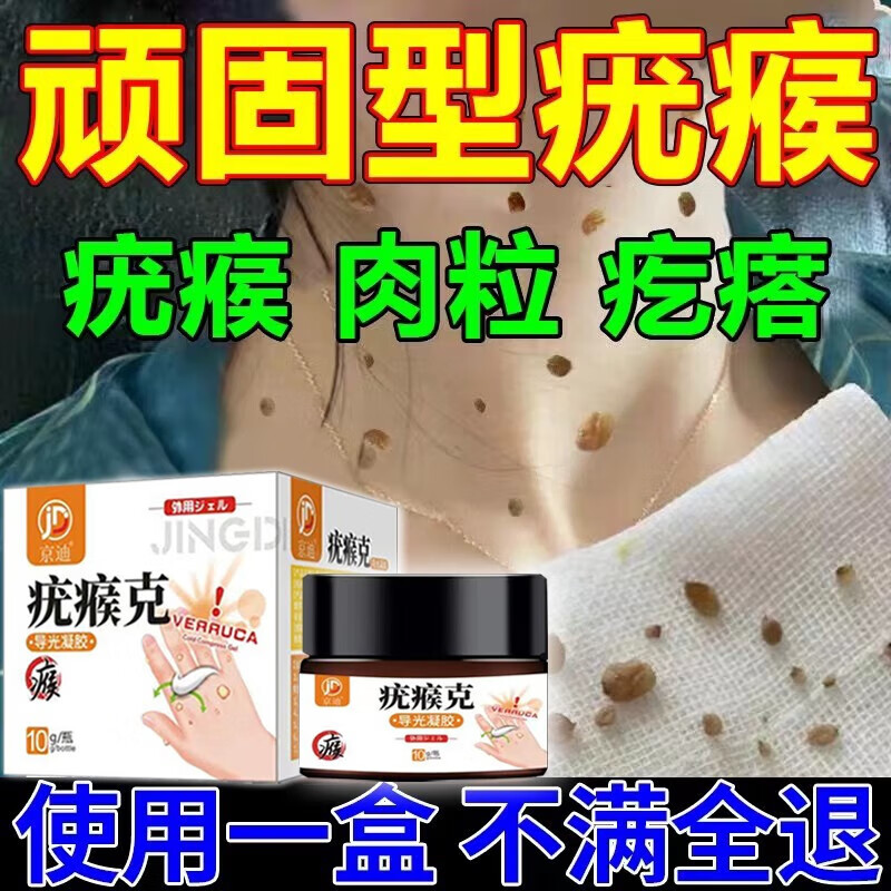 面部脖子面部疣灵小肉粒疣瘊疣膏净疣体尖锐湿疣 1盒装面部扁平疣猴子