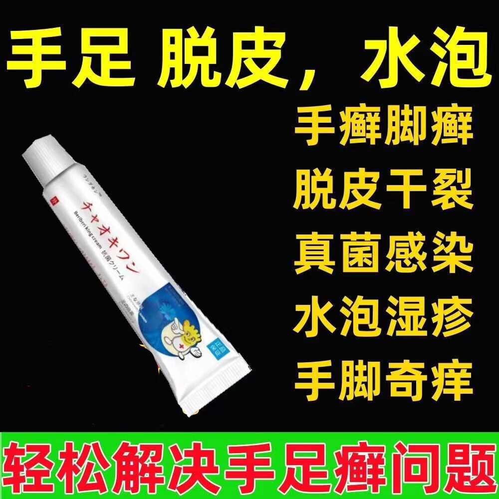 顽达康脚气脚痒去l脚臭汗脚烂l脚丫脱皮水泡糜烂香l港脚杀菌痒膏 买3+2【五盒巩固装】