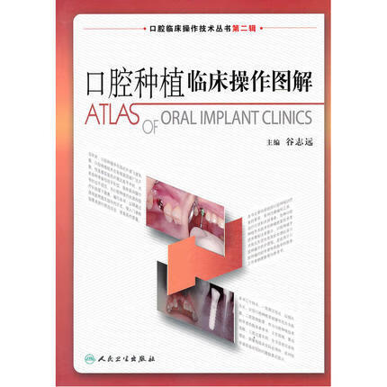 口腔种植临床操作图解 正版正货 新华书店