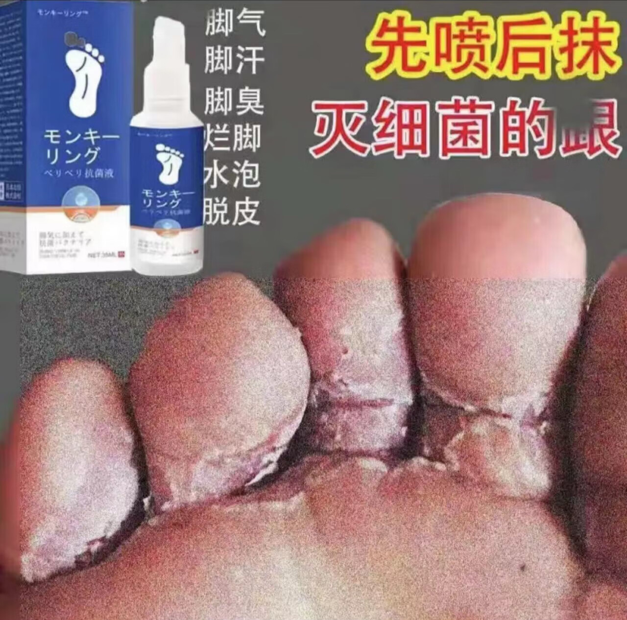 alles japan脚气膏脚臭脚痒烂l脚丫水泡脱皮止养真菌感染脚汗干裂皮肤