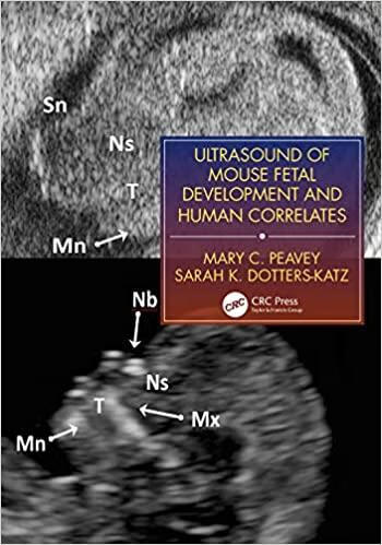 预订ultrasound of murine fetal development with huma