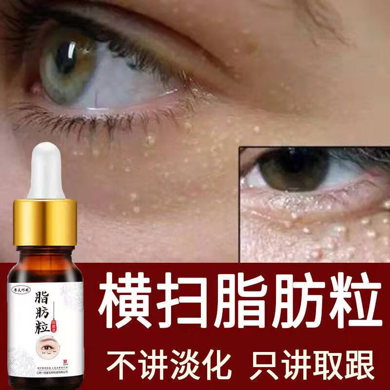 脂肪l粒神器眼皮底下长小白粒皮下脂肪汗管油脂肪精华眼霜细纹黑眼l圈