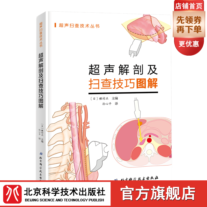 超声解剖及扫查技巧图解
