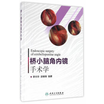 桥小脑角内镜手术学【放心选购】