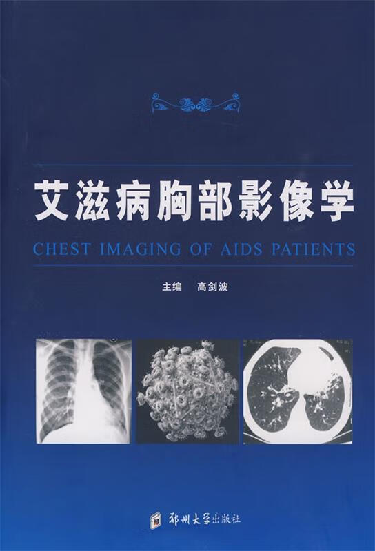 艾滋病胸部影像学 高剑波 郑州大学出版社