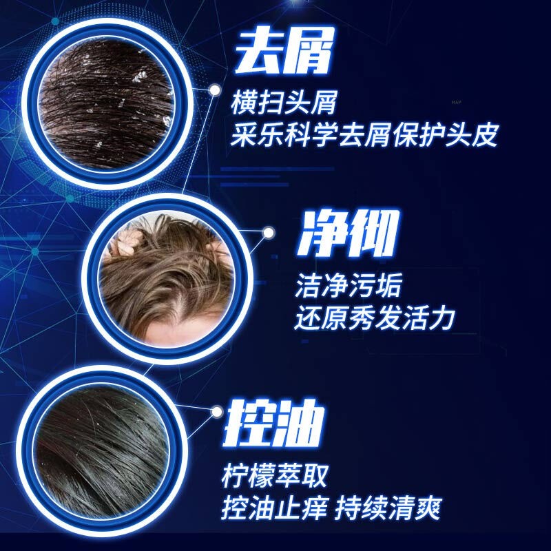 采乐酮康去屑洗发水止痒控油柔顺洗发露去头皮清洁洗头清爽去头屑男女 【去屑止痒】750ml+送40ml