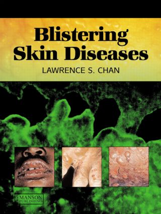 预订 blistering skin diseases