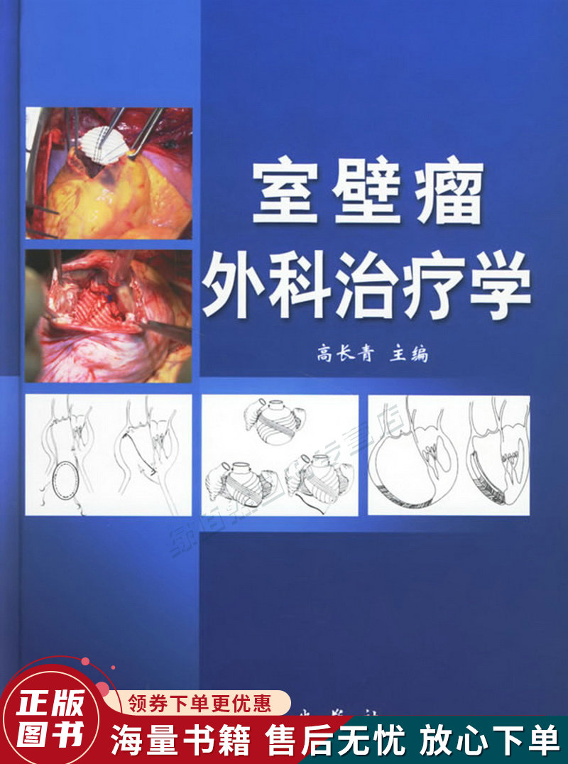 室壁瘤外科治疗学