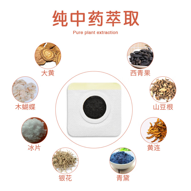 景天堂 咽扁贴儿童腺样体肥大小儿扁桃体发炎喉咙痒肿痛穴位贴 5盒【实惠装】