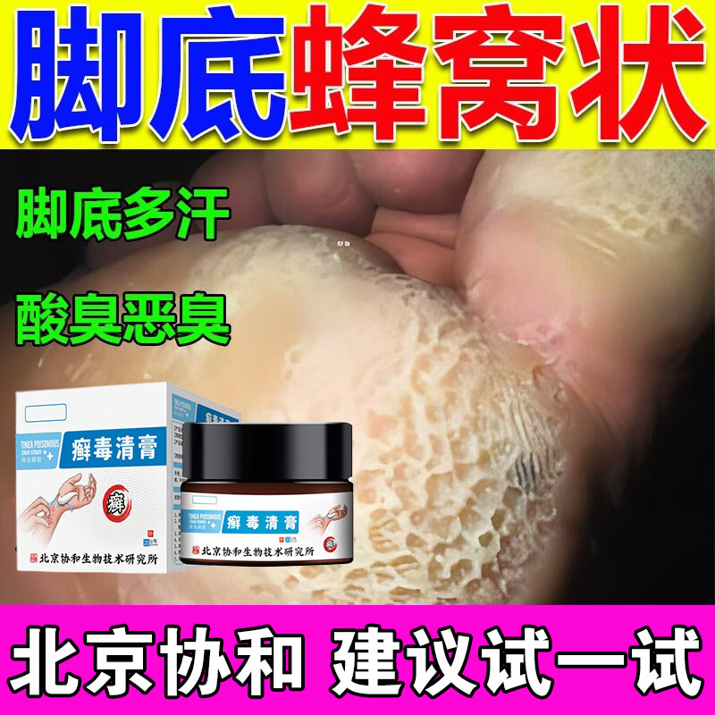 马蜂窝状发白脱皮水泡糜烂喷雾脚丫真菌感染脚臭脚汗沙虫脚治足癣脚气