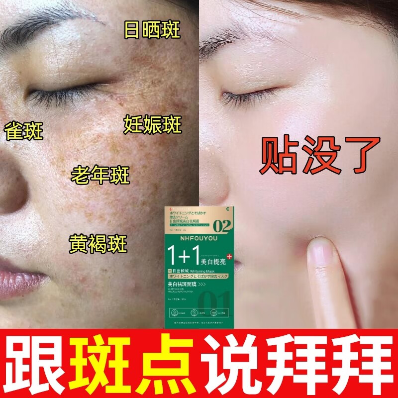 NHFOUYOU祛斑面膜美白补水淡斑提亮肤色女护肤品祛斑霜去黄褐斑老年斑点斑 —盒装【老客户补充装】