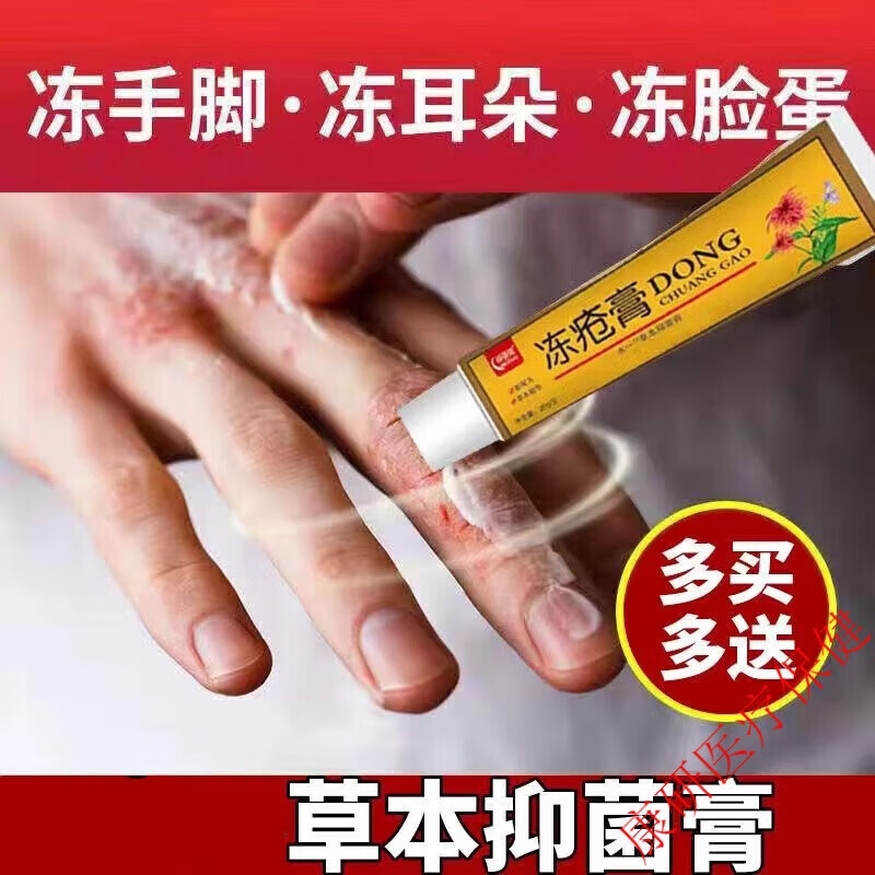冻疮膏裂可宁治手脚裂脸部耳部裂瘙痒红肿凡士林手足冻伤防裂专用