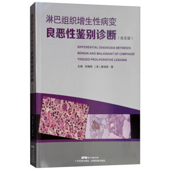 淋巴组织增生性病变良恶性鉴别诊断:普及版