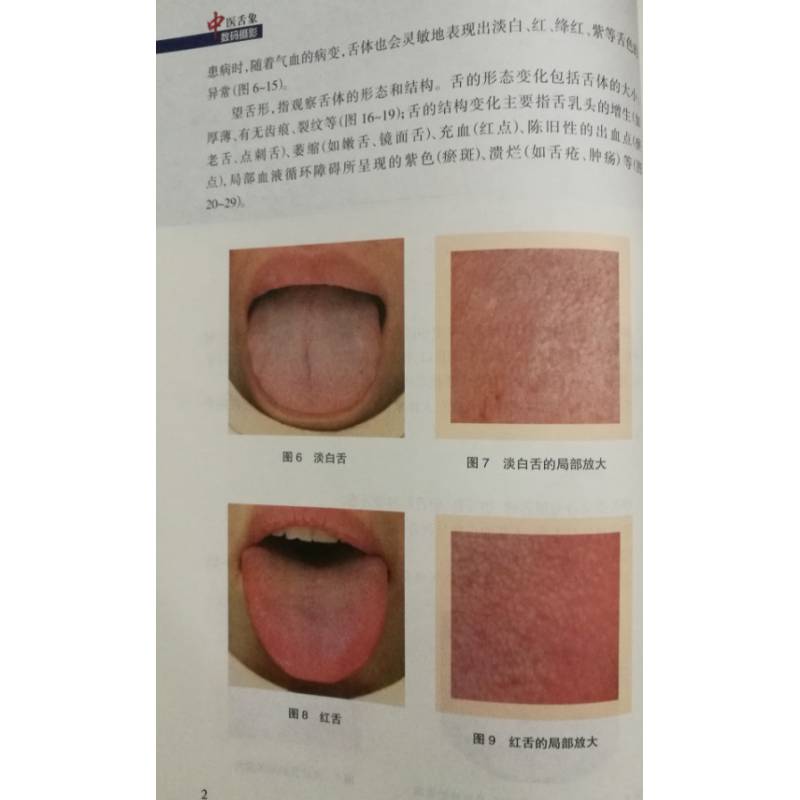 全图解系列丛书:中医舌诊完全图解中医舌象数码摄影舌诊彩图解观舌象