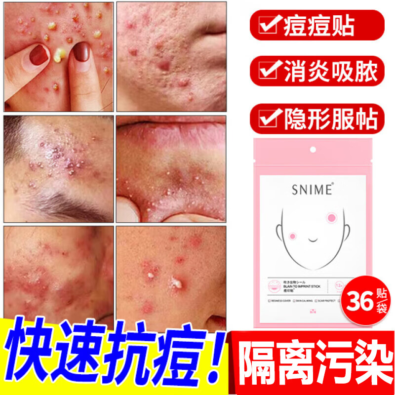 祛痘贴痘痘贴消l炎吸脓隐形去痘痘和痘印痘痘修复消i炎痘印医用非药品