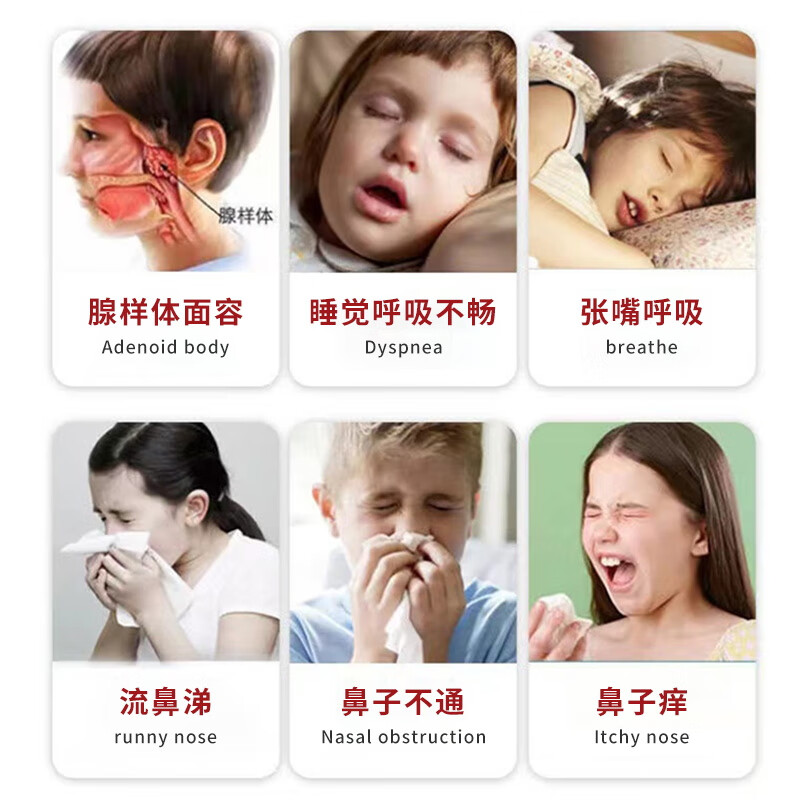 葵花通气鼻贴儿童腺样体肥大贴矫正张嘴呼吸鼻炎鼻甲肥大鼻堵塞不通气 1盒【葵花】一贴通气