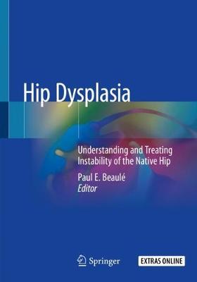 【预订】hip dysplasia