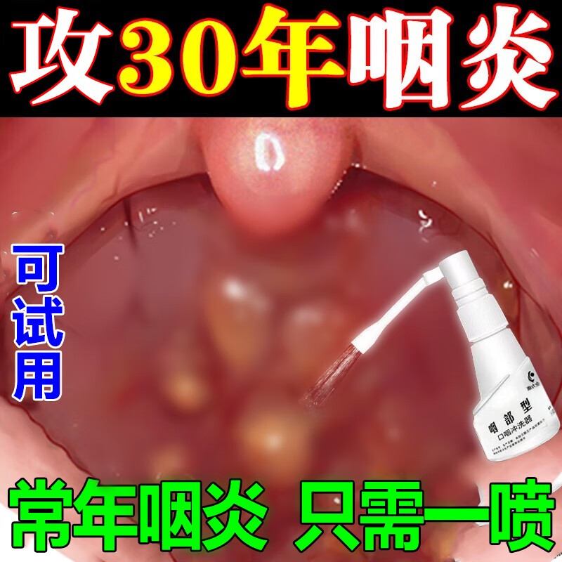 咽炎喷雾剂咳嗽咳喘痰多嗓子疼咽喉肿痛扁桃体发炎肥大去除l根滤 一