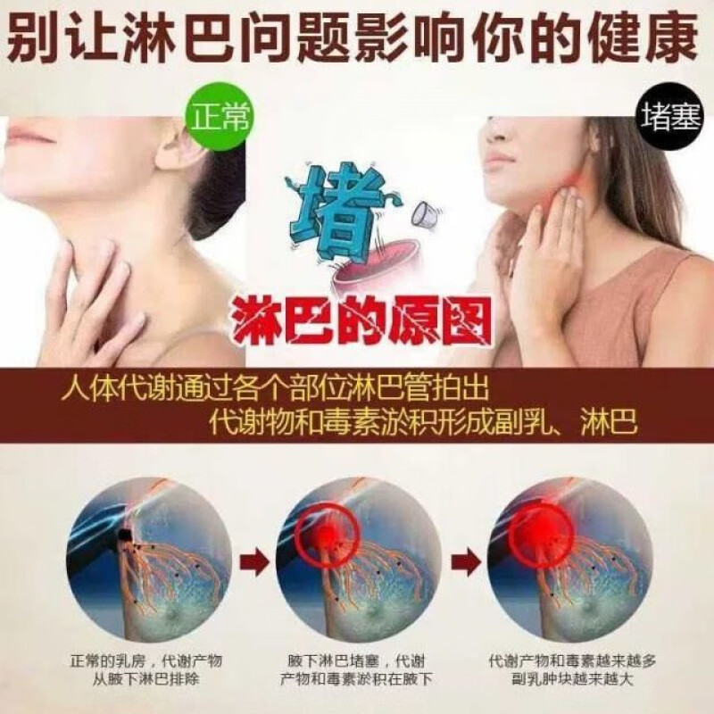 腋窝淋巴结分布图片图片