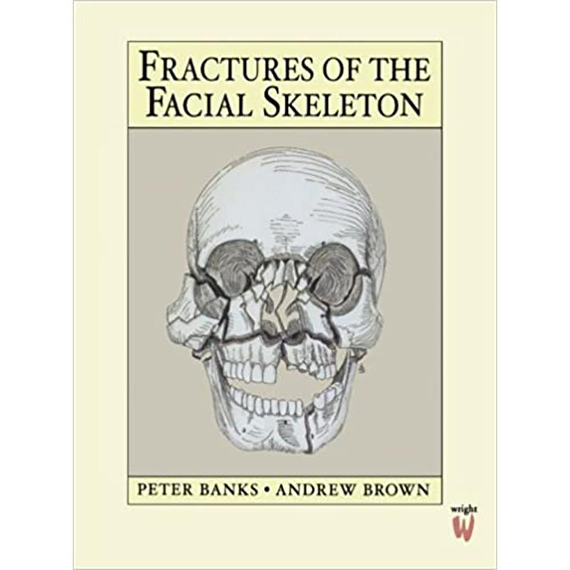 预订fractures of the facial skeleton