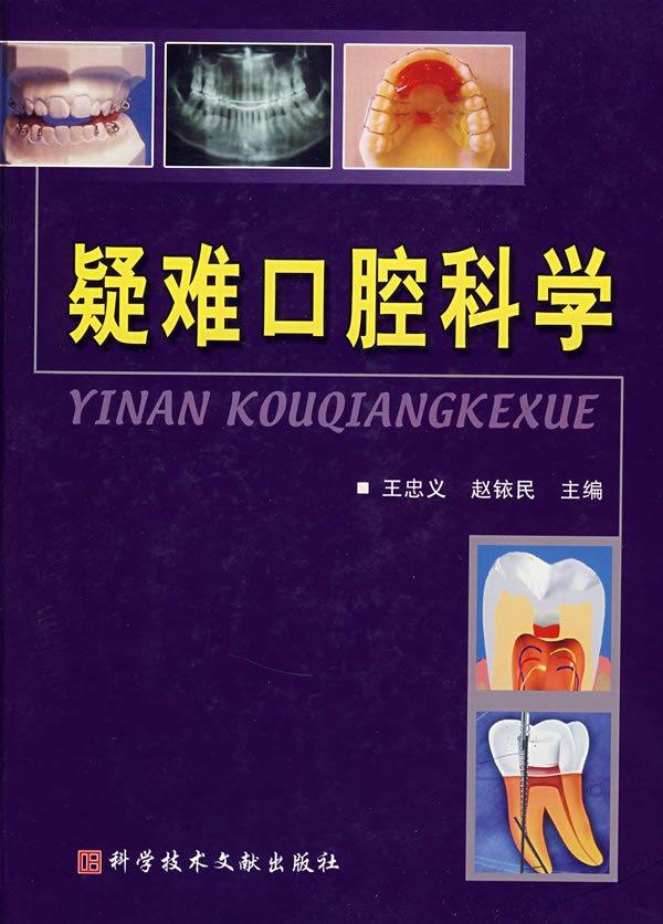 疑难口腔科学【正版图书】