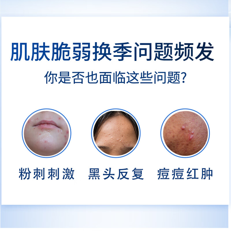 廉溪堂【施芙琳祛痘保健膏凝胶】正品祛痘凝胶保健膏痘痘粉刺黑头外用膏 单盒装