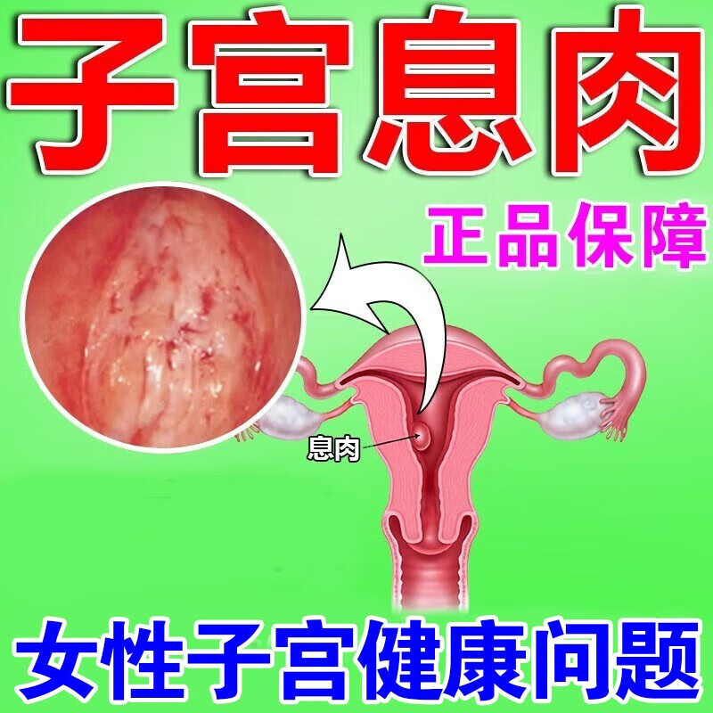 子宫内膜息肉贴宫颈息肉子宫内膜厚薄肌瘤囊肿月经不调异常出血白带异
