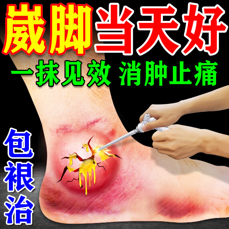 脚踝受伤走路神器崴脚扭伤热敷脚腕疼痛韧带拉伤恢复专用膏药贴 三盒